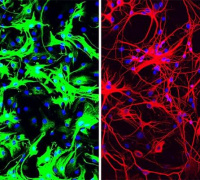 One-time treatment generates new neurons, eliminates Parkinson's disease in mice 